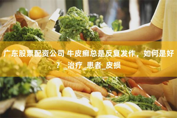 广东股票配资公司 牛皮癣总是反复发作，如何是好？_治疗_患者_皮损